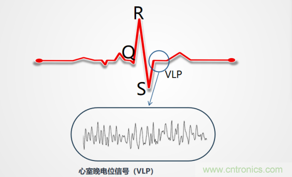 解決心電監(jiān)測(cè)行業(yè)難題，曼森伯格的濾波技術(shù)獲國(guó)家知識(shí)產(chǎn)權(quán)局發(fā)明授權(quán)